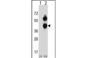 Western blot analysis of BCAT2 (arrow) using rabbit polyclonal BCAT2 Antibody (C-term) (ABIN656822 and ABIN2846033). (BCAT2 antibody  (C-Term))
