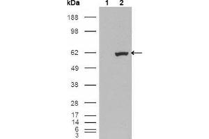 Western blot analysis using ETV1 mouse mAb against HEK293T cells transfected with the pCMV6-ENTRY control (1) and pCMV6-ENTRY ETV1 cDNA (2). (ETV1 antibody  (AA 1-191))