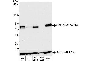 Western Blotting (WB) image for anti-Interleukin 2 Receptor, alpha (IL2RA) (AA 22-213) antibody (ABIN7453339)