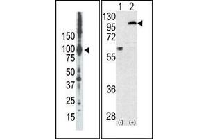 (LEFT)Western blot analysis of anti-PKCepsilon Pab in placenta lysate. (PKC epsilon antibody  (N-Term))