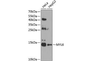 Western blot analysis of extracts of various cell lines, using MYL6 antibody (ABIN6129612, ABIN6144255, ABIN6144257 and ABIN6224653) at 1:1000 dilution. (MYL6 antibody  (AA 1-151))