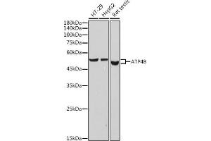 Western blot analysis of extracts of various cell lines, using B antibody (ABIN7265767) at 1:1000 dilution. (ATP4b antibody)