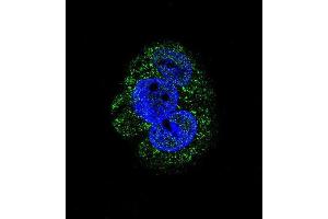 Confocal immunofluorescent analysis of AGL Antibody (Center) (ABIN1882062 and ABIN2839246) with HepG2 cell followed by Alexa Fluor 488-conjugated goat anti-rabbit lgG (green). (AGL antibody  (AA 357-387))