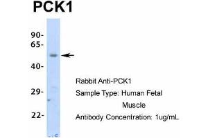 Host:  Rabbit  Target Name:  PCK1  Sample Type:  Human Fetal Muscle  Antibody Dilution:  1. (PCK1 antibody  (Middle Region))