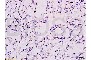 Formalin-fixed and paraffin embedded rat lung tissue labeled with Anti-EPOR Polyclonal Antibody (ABIN686347), Unconjugated at 1:200 followed by conjugation to the secondary antibody and DAB staining