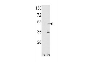 Western blot analysis of AIK using rabbit polyclonal hAIK-H105 using 293 cell lysates (2 ug/lane) either nontransfected (Lane 1) or transiently transfected with the AIK gene (Lane 2). (Aurora A antibody  (N-Term))
