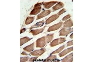 Immunohistochemistry (IHC) image for anti-ARP3 Actin-Related Protein 3 (ACTR3) antibody (ABIN3001697) (ACTR3 antibody)