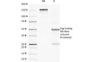SDS-PAGE (SDS) image for anti-Ornithine Decarboxylase 1 (ODC1) antibody (ABIN3026477)