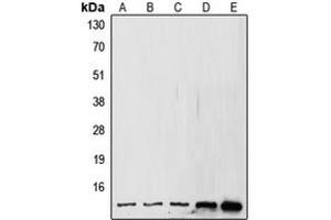 Western blot analysis of SUMO1 expression in MCF7 (A), A431 (B), HeLa (C), mouse kidney (D), rat kidney (E) whole cell lysates. (SUMO1 antibody  (N-Term))