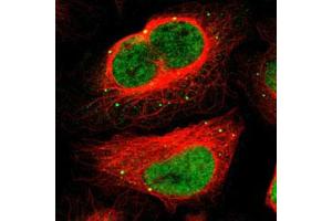 Immunofluorescent staining of U-2 OS with MEF2D polyclonal antibody  (Green) shows positivity in vesicles and nucleus but excluded from the nucleoli. (MEF2D antibody)