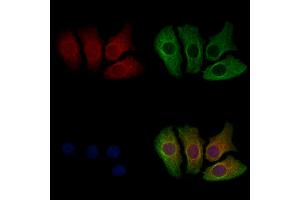 ABIN7094667 and ABIN7098718 staining Hela cells by IF/ICC.
