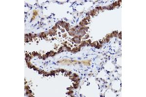 Immunohistochemistry of paraffin-embedded mouse lung using Caspase-6 Rabbit mAb (ABIN7266119) at dilution of 1:100 (40x lens). (Caspase 6 antibody)