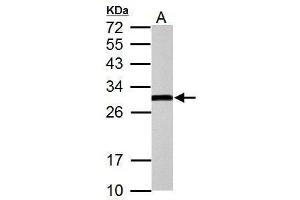 Western Blotting (WB) image for anti-Hydroxysteroid (17-Beta) Dehydrogenase 10 (HSD17B10) (C-Term) antibody (ABIN2854703)