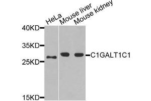 Western blot analysis of extracts of various cells, using C1GALT1C1 antibody. (C1GALT1C1 antibody)