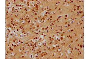IHC image of ABIN7143183 diluted at 1:200 and staining in paraffin-embedded human brain tissue performed on a Leica BondTM system. (ADNP antibody  (AA 867-1102))
