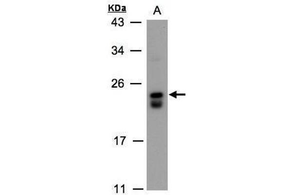 DUSP19 antibody