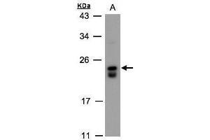 WB Image Sample(30 ug whole cell lysate) A:Raji , 12% SDS PAGE antibody diluted at 1:500 (DUSP19 antibody)