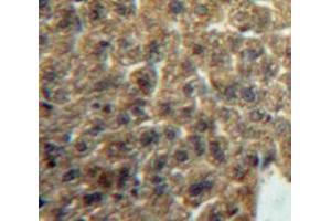 Used in DAB staining on fromalin fixed paraffin-embedded Liver tissue (Lacritin antibody  (AA 20-138))