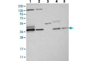 Western blot analysis of Lane 1: RT-4, Lane 2: U-251 MG, Lane 3: Human Plasma, Lane 4: Liver, Lane 5: Tonsil with VTA1 polyclonal antibody  at 1:250-1:500 dilution. (VTA1 antibody)