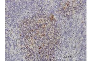 Image no. 1 for anti-Phosphoinositide-3-Kinase, Catalytic, beta Polypeptide (PIK3CB) (AA 147-257) antibody (ABIN466076) (PIK3CB antibody  (AA 147-257))