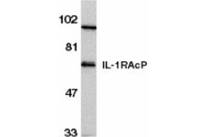 Image no. 1 for anti-Interleukin 1 Receptor Accessory Protein (IL1RAP) (C-Term) antibody (ABIN202581) (IL1RAP antibody  (C-Term))