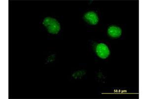 Immunofluorescence of purified MaxPab antibody to CDCA8 on HeLa cell. (CDCA8 antibody  (AA 1-280))