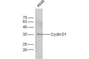 A549 cells probed with Anti-Cyclin D1 Polyclonal Antibody  at 1:5000 90min in 37˚C. (Cyclin D1 antibody  (AA 61-110))