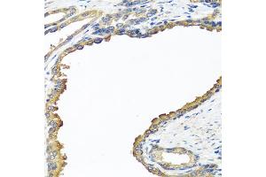Immunohistochemistry of paraffin-embedded human prostate using NYX antibody. (Nyctalopin antibody)