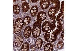 Immunohistochemical staining of human colon with DCTN5 polyclonal antibody  shows strong cytoplasmic positivity in glandular cells.