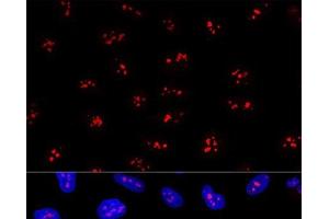 Confocal immunofluorescence analysis of U2OS cells using EBNA1BP2 Polyclonal Antibody at dilution of 1:200. (EBNA1BP2 antibody)