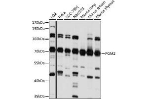Western blot analysis of extracts of various cell lines, using PGM2 antibody (ABIN7269312) at 1:1000 dilution.