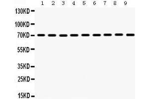 Western Blotting (WB) image for anti-Heat Shock 70kDa Protein 2 (HSPA2) (AA 564-598), (C-Term) antibody (ABIN3043850) (HSPA2 antibody  (C-Term))