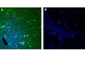 Free-floating frozen brain sections from a paraformaldehyde-perfused rat were incubated with Anti-GPR151 (extracellular) antibody (ABIN7884968, 1:300), followed by goat anti-rabbit secondary antibody conjugated to Alexa Fluor® 488 (green).