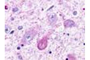 Anti-TAAR5 antibody IHC of human brain, thalamus, neurons and glia. (TAAR5 antibody  (Cytoplasmic Domain))