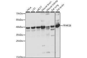 Western blot analysis of extracts of various cell lines, using PPB antibody (ABIN7269278) at 1:1000 dilution. (PPAP2B antibody  (AA 1-100))