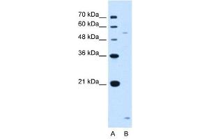 ST3GAL5 antibody used at 1. (ST3GAL5 antibody  (N-Term))