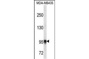 Western blot analysis in MDA-MB435 cell line lysates (35ug/lane). (PLOD3 antibody  (N-Term))