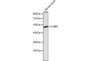 Western blot analysis of extracts of mouse brain, using CtBP1 Antibody (ABIN3022421, ABIN3022422, ABIN3022423, ABIN1512783 and ABIN6218809) at 1:1000 dilution. (CTBP1 antibody  (AA 20-250))