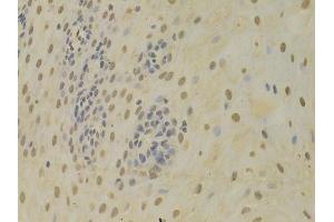 Immunohistochemistry (Paraffin-embedded Sections) (IHC (p)) image for anti-Heterogeneous Nuclear Ribonucleoprotein K (HNRNPK) (AA 1-280) antibody (ABIN3022414)
