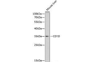 Western blot analysis of extracts of Mouse liver using CD1D Polyclonal Antibody at dilution of 1:1000.