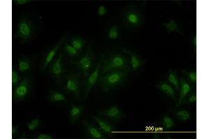 Immunofluorescence of monoclonal antibody to PCQAP on HeLa cell. (MED15 antibody  (AA 1-88))