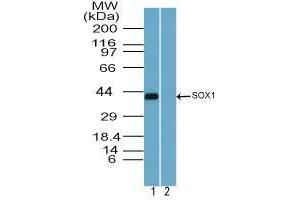 Image no. 3 for anti-SRY (Sex Determining Region Y)-Box 1 (SOX1) (AA 100-150) antibody (ABIN960348)