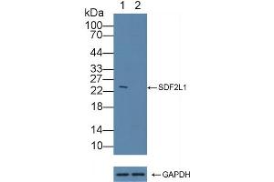 Western Blotting (WB) image for anti-Collagen, Type III, alpha 1 (COL3A1) (AA 1059-1466) antibody (ABIN7435406)