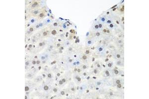 Immunohistochemistry of paraffin-embedded mouse liver using TARDBP antibody (ABIN6290985) at dilution of 1:100 (40x lens).