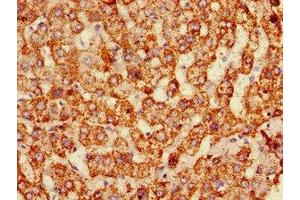 Immunohistochemistry of paraffin-embedded human liver tissue using ABIN7159651 at dilution of 1:100