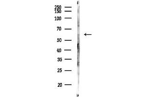 anti-FEZ Family Zinc Finger 1 (FEZF1) antibody