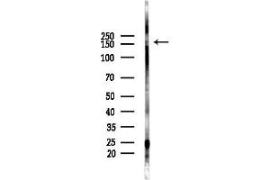 anti-LATS1,2 (Internal Region) antibody