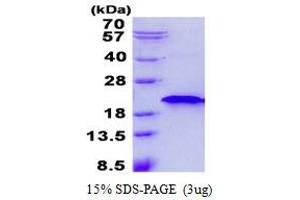 Image no. 1 for Ring Finger Protein 181 (RNF181) protein (His tag) (ABIN1098396) (RNF181 Protein (His tag))