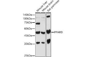 Western blot analysis of extracts of various cell lines, using PPARD antibody (ABIN6132423, ABIN6146002, ABIN6146003 and ABIN6221300) at 1:1000 dilution. (PPARD antibody  (AA 102-361))