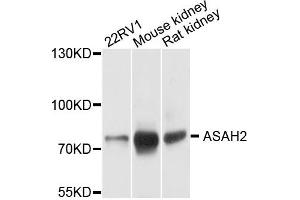 Western blot analysis of extracts of mouse testis, using ASAH2 antibody. (ASAH2 antibody)